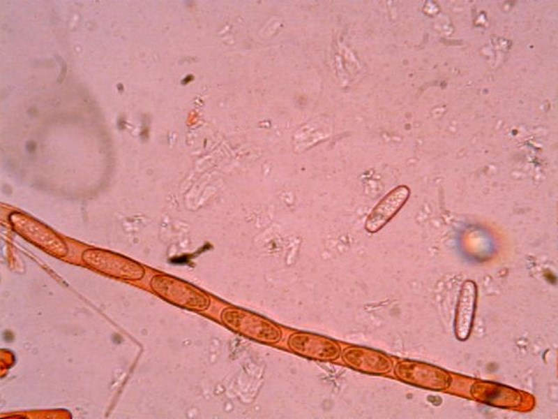 Sarcoscypha coccinea foto Antonio Tacconi (C.jpg